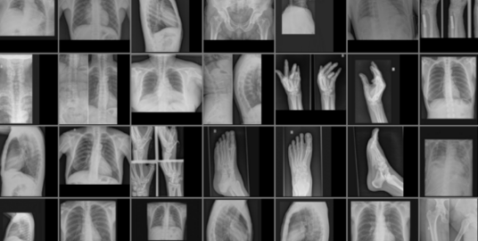 身体部位X射线图像数据集