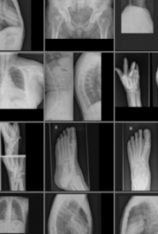 身体部位X射线图像数据集